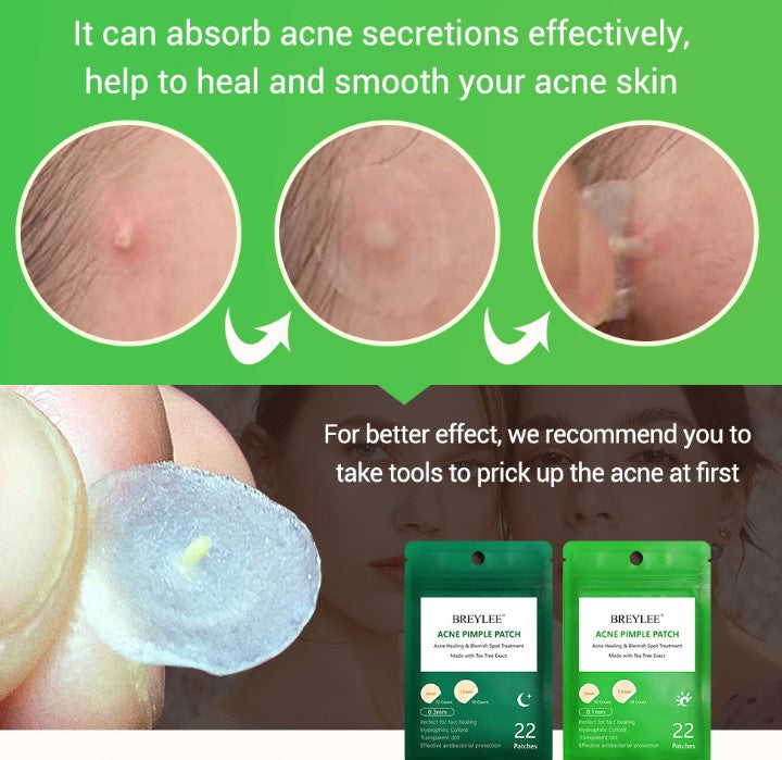 Tea Tree Acne Patch Fades Acne Marks and Ultra-thin - MAXXLIFE ONLINE STORE