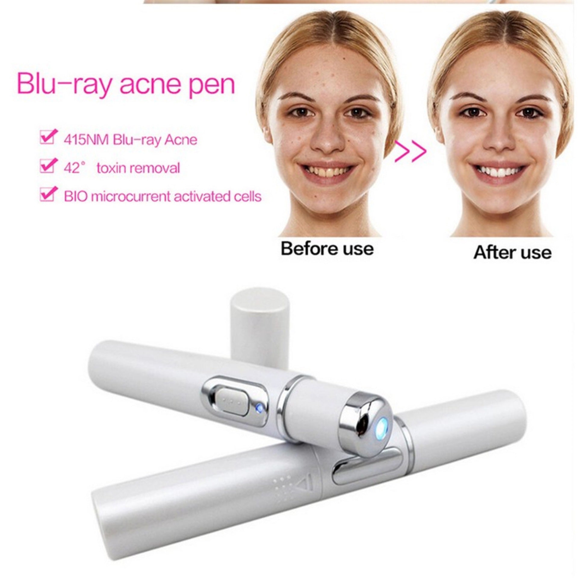 Blue Light Therapy Acne Laser Pen Soft Scar Wrinkle Removal Treatment Device Skin Care Beauty Equipment - MAXXLIFE ONLINE STORE