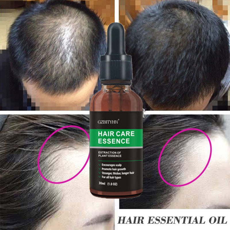 Hair Growth Oil Hair Growth Oil Oem Hair Care Essential Oil - MAXXLIFE ONLINE STORE