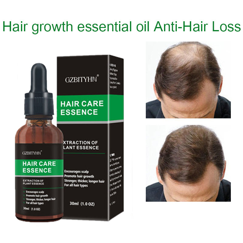 Hair Growth Oil Hair Growth Oil Oem Hair Care Essential Oil - MAXXLIFE ONLINE STORE