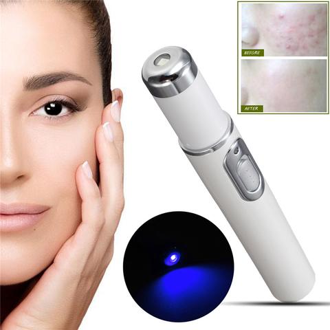 Blue Light Therapy Acne Laser Pen Soft Scar Wrinkle Removal Treatment Device Skin Care Beauty Equipment - MAXXLIFE ONLINE STORE