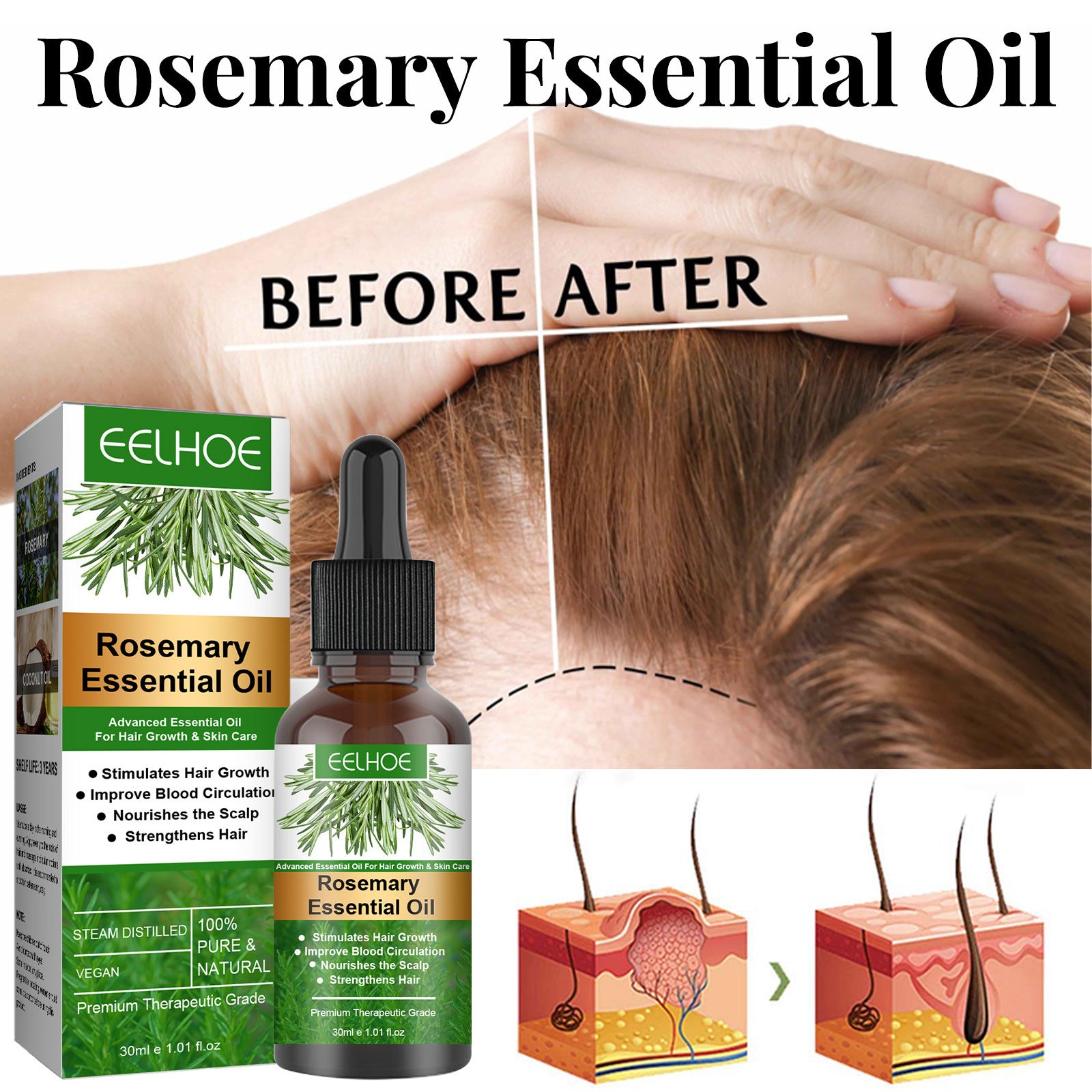 Rosemary Anti-Breakage Nourishing Hair Care Oil - MAXXLIFE ONLINE STORE