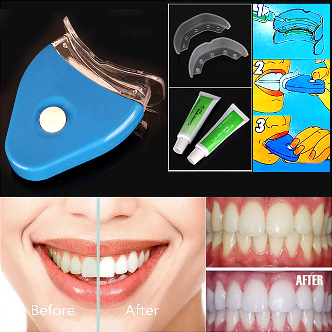 Oral Gel Teeth Tooth Whitening Whitener Dental Bleaching LED - MAXXLIFE ONLINE STORE